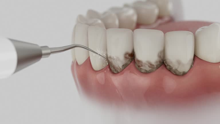 Reliable Root Canal Treatment contractor in Summit County County, CO by Dentist Open Now
